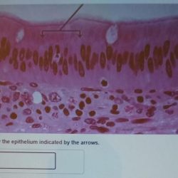 Identify the epithelium indicated by the arrows