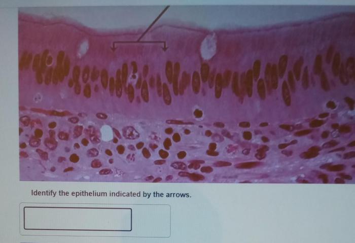 Identify the epithelium indicated by the arrows