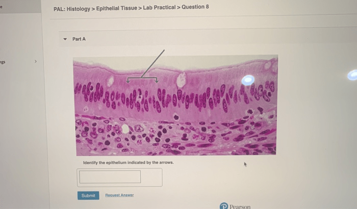 Epithelium indicated