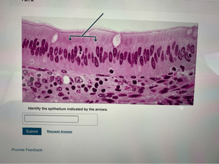 Identify the epithelium indicated by the arrows